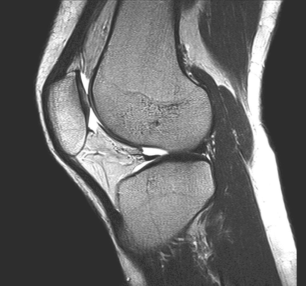 MRT Knie PD Drive MRT Knie PD Drive