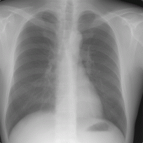 Digitale Radiographie